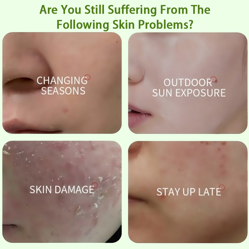 5% Panthenol And 2% Alpha Arbu - Alpha Arbutin Serum 리뷰 및 가격
