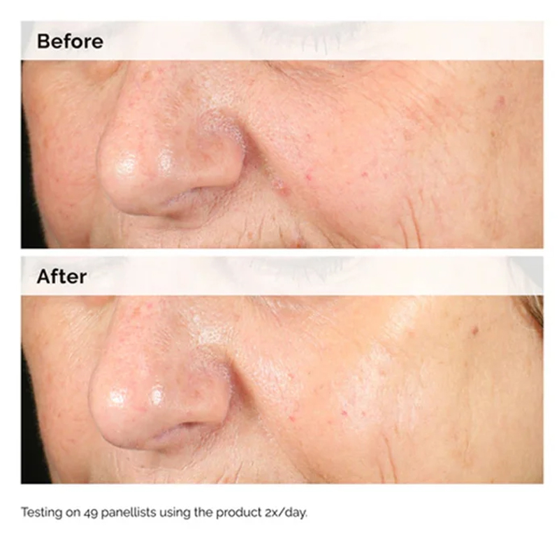 Alpha Arbutin 2% + HA 30ml Ser - Skincare Oily Skin 리뷰 및 가격