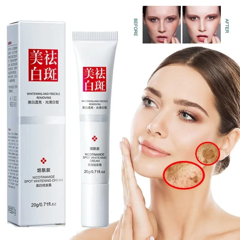 Fade and Improve Freckles Blac - Skincare Glow 리뷰 및 가격