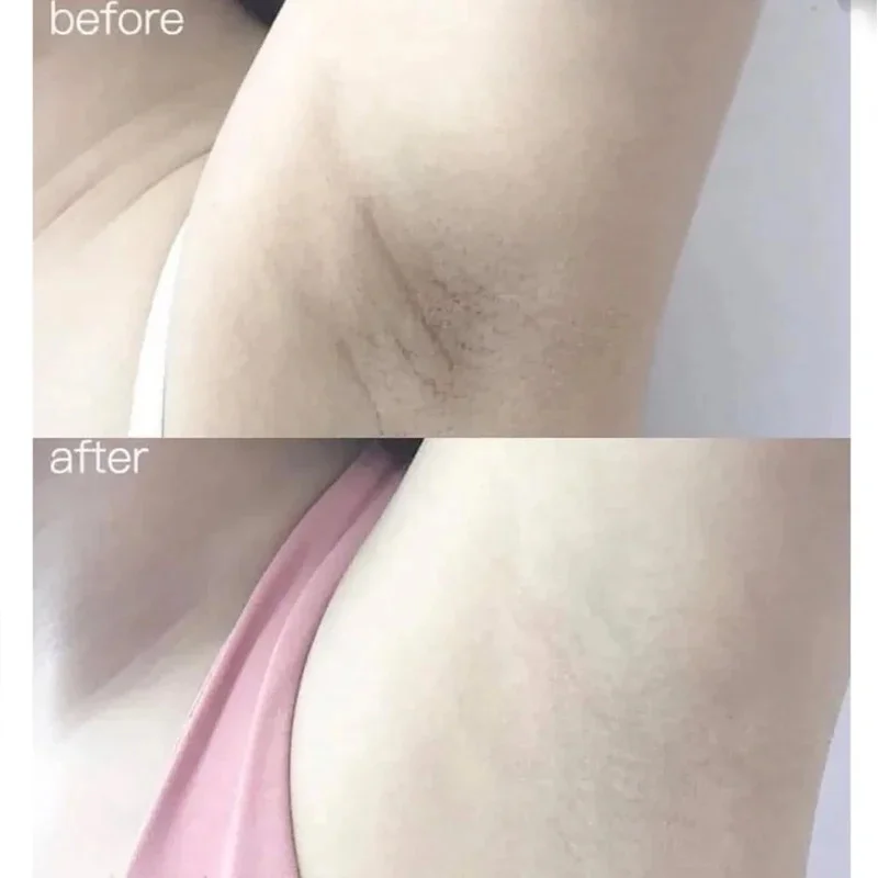 100ml Alpha Arbutin Collagen W - Alpha Arbutin Serum 리뷰 및 가격