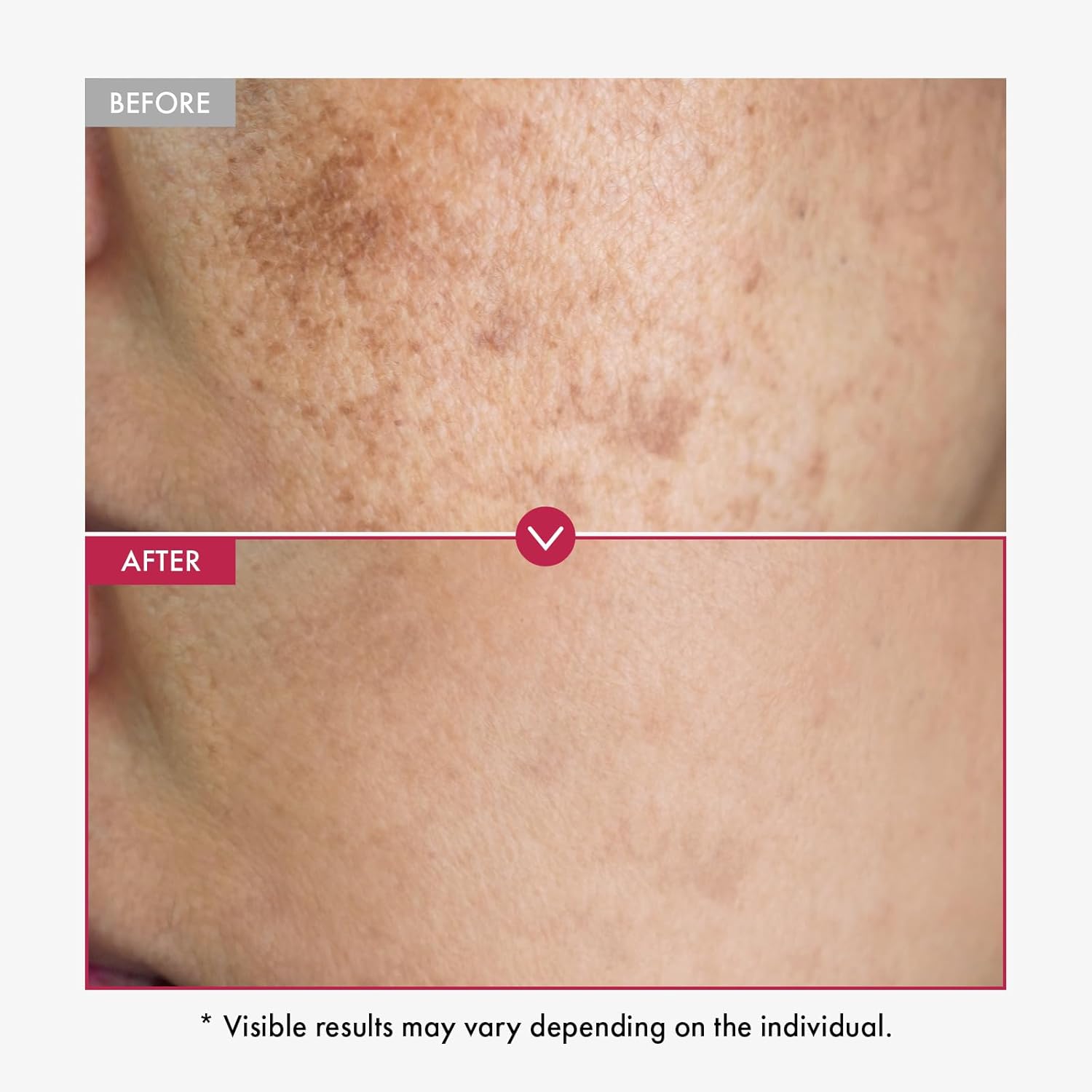 Alpha Arbutin Serum AHA Keeps  - Alpha Arbutin Serum 리뷰 및 가격