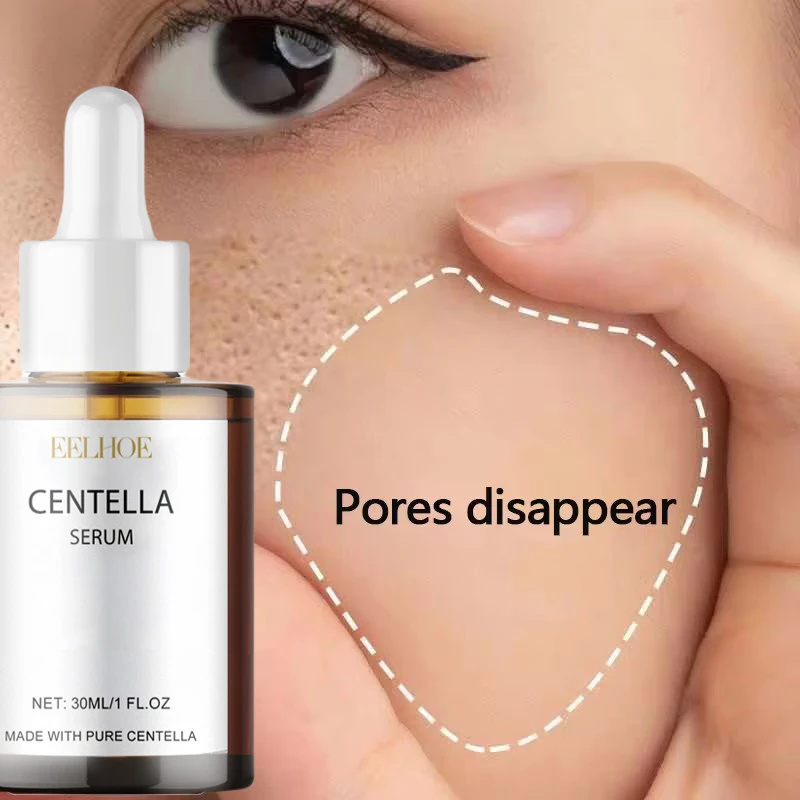 Centella Asiatica Face Serum N - Skincare Oily Skin 리뷰 및 가격