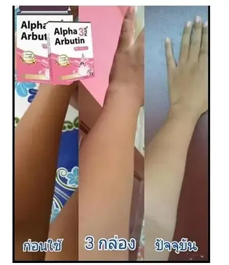 Alpha Arbutin 3 Plus Powder Mi - Alpha Arbutin Serum 리뷰 및 가격