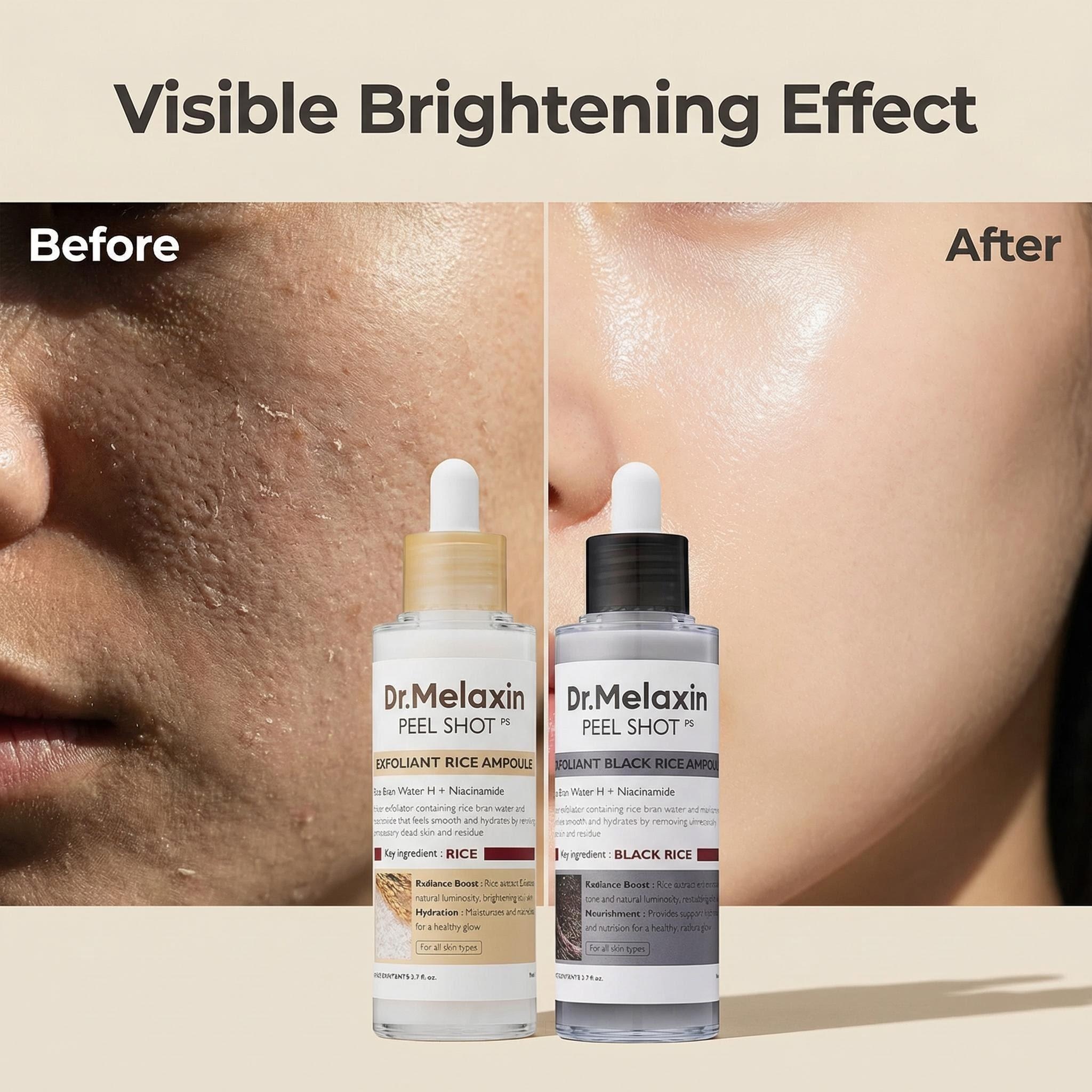 Black Rice Exfoliating Ampoule - Aha Bha Exfoliant 리뷰 및 가격